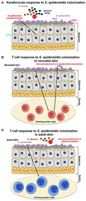 Host Response to Staphylococcus epidermidis Colonization and Infections